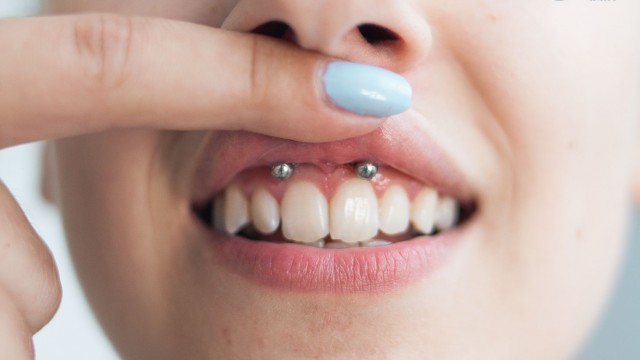 Kolczykowanie smile
